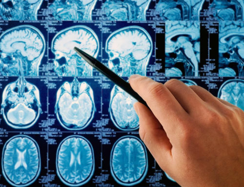 Noi abordări în cacerul de creier