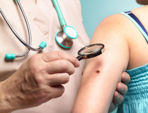 Cancerul de piele, factori de risc