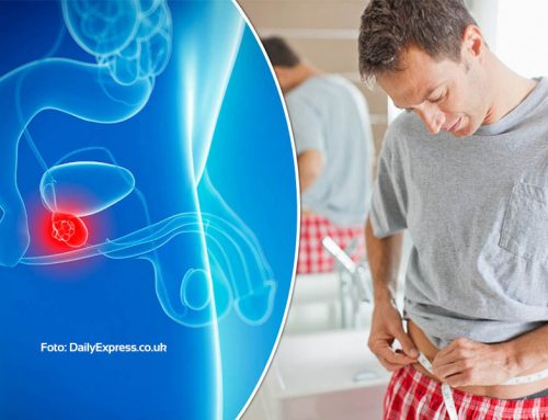 Analize pentru cancerul de prostată